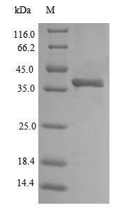 (Tris-Glycine gel) Discontinuous SDS-PAGE (reduced) with 5% enrichment gel and 15% separation gel.